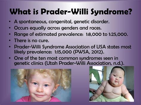 how is prader willi inherited.